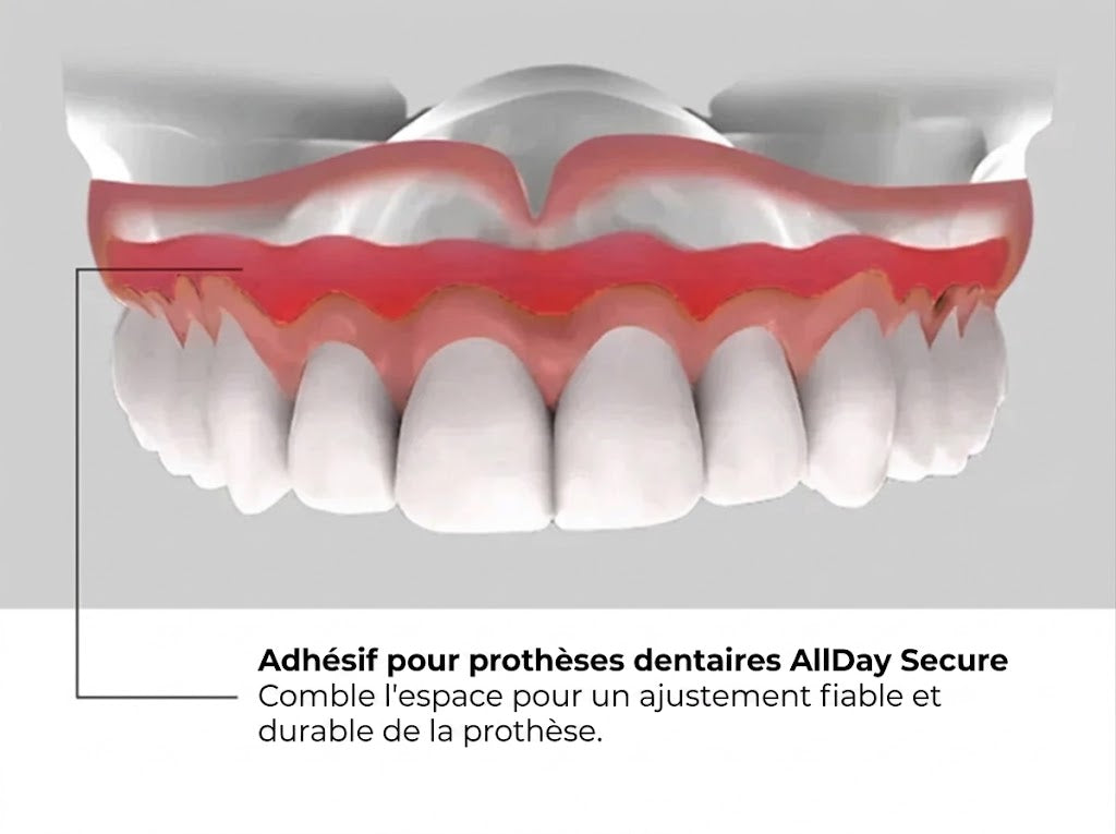 Allday Secure adhésif puissant pour prothèses dentaires