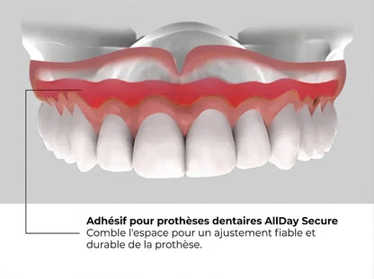 Allday Secure adhésif puissant pour prothèses dentaires