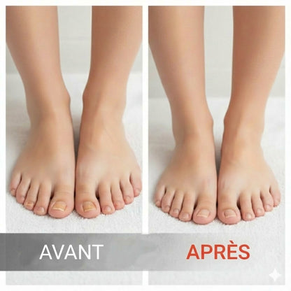 Essence réparatrice pour ongles abîmés