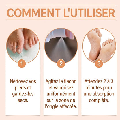 Spray pour les ongles au venin d'abeille – soin efficace pour vos ongles