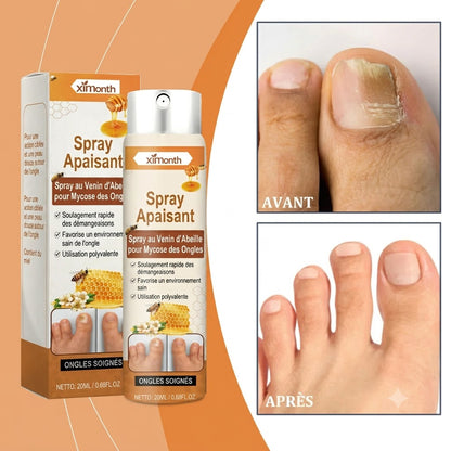 Spray pour les ongles au venin d'abeille – soin efficace pour vos ongles