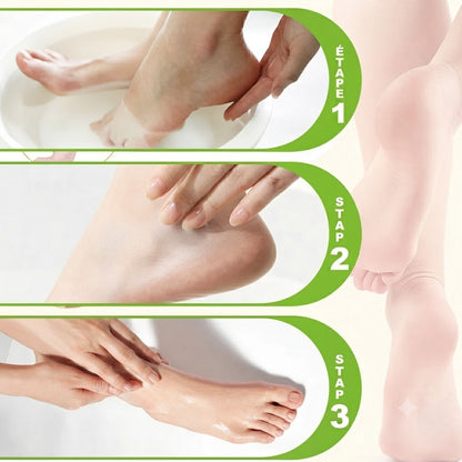 Crème hydratante pour les pieds contre les crevasses