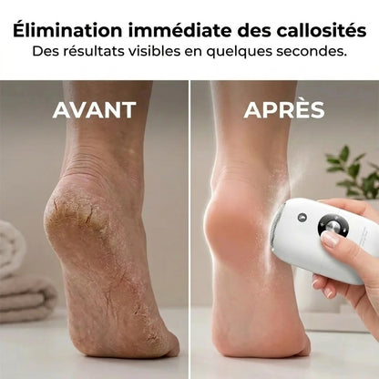 Râpe électrique pour les pieds et les callosités