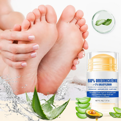 Crème hydratante pour les pieds contre les crevasses
